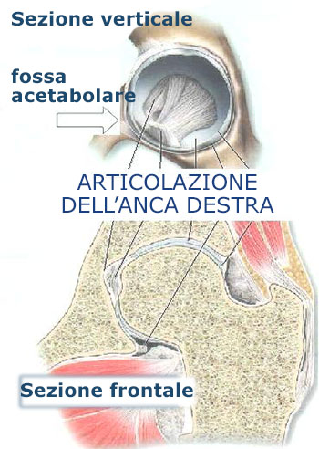coxalgia coxalgia