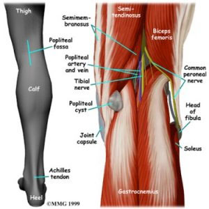 Gonalgia Gonalgia